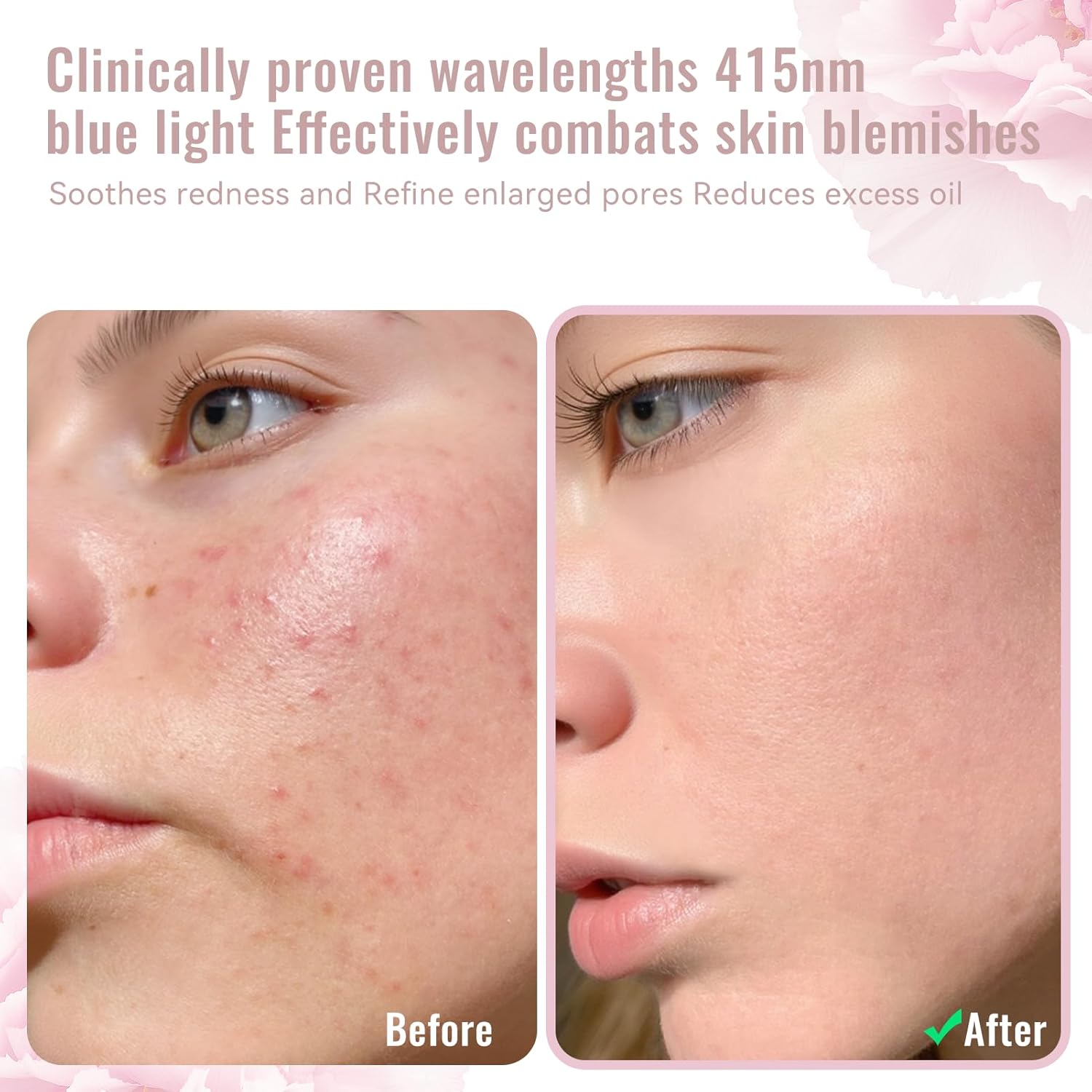 Red Light Therapy Mask for Face – 4-Mode LED Light Therapy with Infrared & Blue Light