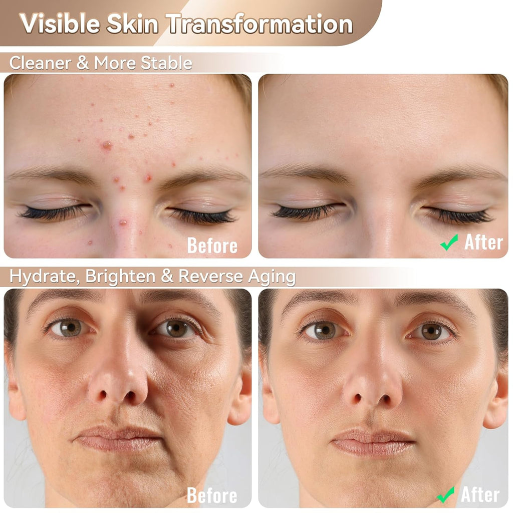 Red Light Therapy Mask for Face – 4-Mode LED Light Therapy with Infrared & Blue Light